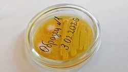 Медики предупредили жителей Чернянского округа об опасности ротавирусной инфекции 