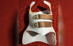 Фонд «Поколение» помог 13-летней Софии Озырянской из села Ковылено приобрести дорогостоящий корсет