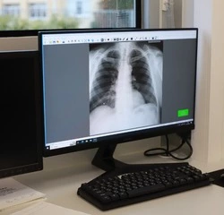 Чернянские медики проинформировали население о профилактике онкологических заболеваний